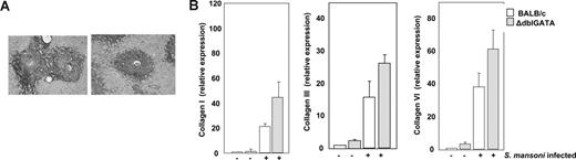 Figure 5. Hepatic fibrosis in response to S mansoni infection. (A) Picrosirius red staining of fibrous tissue in granulomata of wild-type BALB/c and eosinophil lineage–ablated ΔdblGATA mice at week 8 of infection. (B) Differential expression of transcripts encoding collagen I, collagen III, and collagen VI in liver RNA from uninfected and S mansoni–infected BALB/c and ΔdblGATA mice. Values are mean fold change ± SEM with expression in uninfected BALB/c mice normalized to 1.0.