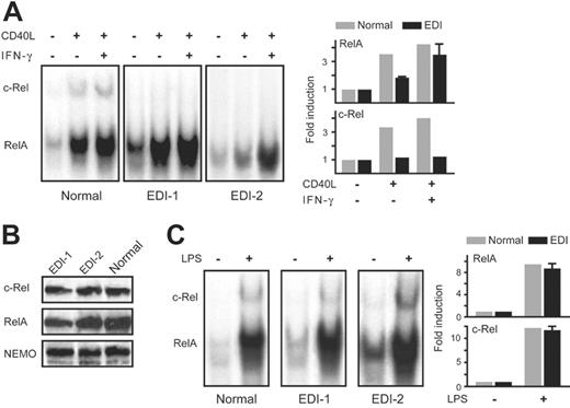 Figure 1. NEMO C417R mutation impairs RelA activation and abolishes c-Rel induction in MoDCs stimulated with CD40L but not with LPS. (A) Left panel shows DNA binding activity of NF-κB dimers in MoDCs stimulated with CD40L (2.5 μg/mL) or CD40L plus IFN-γ (2000 U/mL) for 4 hours. Anti–c-Rel antibody was added prior to incubation with the labeled NF-κB DNA probe to supershift c-Rel containing dimers. Right panel shows quantification of RelA and c-Rel activity represented as means ± SEM of fold change compared with unstimulated cells (set at 1.0). (B) NEMO, c-Rel, and RelA protein levels in MoDCs. Cell lysates from 2 healthy volunteers and 1 patient with EDI were subjected to immunoblotting. Blots were probed with anti–c-Rel, anti-RelA, or anti-NEMO antibody. (C) Left panel shows DNA-binding activity of NF-κB dimers in MoDcs stimulated with LPS (2.5 μg/mL) for 4 hours and processed as in panel A. Right panel shows quantification of RelA and c-Rel activity represented as means ± SEM of fold change compared with unstimulated cells (set at 1.0).