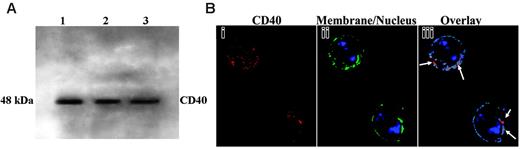 Figure 3. Expression of CD40 in human PMNs by Western blot analysis and localization of CD40 by digital microscopy. (A) Experiments were performed on 3 donors. Proteins from PMN whole cell lysates (1.25 × 106) were separated by sodium dodecyl sulfate–polyacrylamide gel electrophoresis (SDS-PAGE) and were immunoblotted with a monoclonal antibody to human CD40. The CD40 glycoprotein band is present at 48 kDa. (B) Fixed PMNs were incubated with a human CD40 monoclonal antibody, and then the images were prepared for digital microscopy as previously described.12 (i) CD40 immunoreactivity is red because of the secondary donkey antimouse antibody conjugated to Cy3. (ii) The membrane is green because of the association of the wheat germ agglutinin (WGA)–AlexaFluor 488 with salicylic acids, and the nucleus is stained blue with the fluorescent bis-benzimide nuclear dye. (iii) Colocalization of CD40 and the plasma membrane is displayed in pseudocolor. Arrows point to the red area, where a high amount of colocalization is present. Blue represents low colocalization between CD40 and the plasma membrane. These images are representative of 3 different experiments on the PMNs of 3 donors.