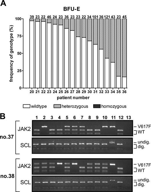 Figure 2. Frequency of V617F homozygosity in patients with ET. (A) Frequencies of wild-type, V617F-heterozygous, and V617F-homozygous BFU-Es in the peripheral blood of 17 ET patients were determined using PCR and BsaXI digestion. The number of colonies genotyped from each patient is at the top of each column. (B) BsaXI digestion of JAK2 exon 14 and SCL intron 1 was used to genotype DNA from peripheral blood BFU-Es cultured from 2 ET patients following transformation to PV (patients 37 and 38). Lanes 1-10 show individual colonies; lane 11, undigested granulocyte DNA from a V617F-negative control; lane 12, BsaXI-digested granulocyte DNA from a V617F-negative control; and lane 13, water.