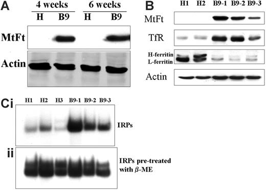Figure 1. Expression of MtFt in tumor xenografts and effects of MtFt expression on TfR, cytosolic ferritin levels, and RNA binding activity of IRPs. (A) MtFt expression in parental H1299 cell (H)–derived and MtFt-expressing B9 cell (B9)–derived tumor xenografts at 4 and 6 weeks after tumor injection. (B) Enhanced expression of TfR and decreased expression of cytosolic ferritin were observed in MtFt-expressing tumor xenografts. The tumor lysates were analyzed for protein expression of MtFt, TfR, cytosolic ferritin, and actin by Western blotting. (C) Increased RNA binding activity of IRPs in B9 cell–derived tumor lysates. Nine weeks after tumor cell injection, tumors were dissected and homogenized in Munro buffer. Equal amounts of tumor extracts were assayed for their ability to retard the migration of a 32P-labeled IRE probe in the absence (i) or presence of 2% β-ME (ii).