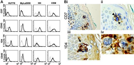 Figure 1. Loss of core 2 O-glycan expression by neoplastic CD7+ T cells. (A) HUT78, MyLa2059, and HH cell lines derived from patients with SS were analyzed for expression of CD7, CD43, and CD45, the major glycoprotein receptors for galectin-1, and for reactivity with 1D4 mAb that recognizes core 2 O-glycans on human CD43. CEM T-acute lymphoblastic leukemia cells were used as a positive control. (B) Representative patch stage MF lesion with neoplastic Sézary T cells infiltrating the dermis and epidermis. (Bi) Immunohistochemistry with anti-CD7 demonstrates atypical expression of CD7 by Sézary cells seen singly in the dermis (bottom left) and in characteristic microabscesses in the epidermis (center). (Bii) Tumor cells in a microabscess demonstrate cell surface reactivity with anti-CD7 (arrowheads). (Biii) Immunohistochemistry with 1D4 shows that both 1D4+ cells (arrowhead) and 1D4– cells (arrow) are present in a microabscess. (Biv) Characteristic Sézary cells with large, highly convoluted nuclei demonstrate lack of 1D4 reactivity at the cell surface (arrow). Original magnification × 200 (Bi), × 400 (Bii-iii) and × 1000 (Biv).