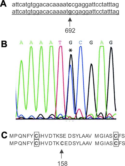 Figure 3. HH cells are heterozygous for a point mutation in C2GnT-I. (A) Partial sequence alignment of C2GnT-I cDNA from HH cells (underlined) with human C2GnT-I cDNA sequence derived from NCBI Nucleotide Database, accession number BC074885. The 692 C/G mutation is indicated in bold (arrow). Sequences were aligned using NCBI Blast 2 sequences. (B) Chromatogram from the C2GnT-I cDNA forward strand sequence from HH cells, demonstrating the 692 C/G mutation. The asterisk (*) denotes overlapping peaks, indicating that the cells are heterozygous for the mutation. (C) Partial amino acid sequence alignment of the predicted C2GnT-I nucleotide sequences from HH cells, translated with the ExPASy Translate Tool. The 692 C/G mutation results in a substitution of Cys for Ser at position 158 (arrow). Boxes indicate Cys residues that are highly conserved in the β1,6-N-acetylglucosaminyltransferase family.