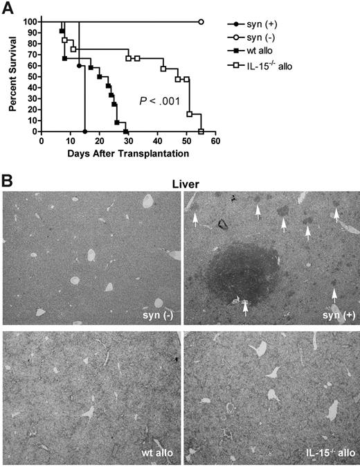 Figure 5. GVT activity is preserved in the absence of donor-derived IL-15. (A) Lethally irradiated wt B6D2F1 mice received 2000 log-phase P815 cells, 5 × 106 wt B6 splenic T cells, and 1 × 107 TCD BM cells from either wt B6 (wt allo, ▪, n = 12) or IL-15–/– B6 (IL-15–/– allo, □, n = 12) mice. As controls, identical mice received 5 × 106 wt B6D2F1 (syngeneic) T cells and 1 × 107 wt B6D2F1 TCD BM cells plus (syn (+), •, n = 5) or minus (syn (-), ○, n = 5) 2000 P815 cells. Animals were monitored daily after transplantation and survival times were compared using the logrank test. Results are combined from 3 similar experiments. (B) Livers were harvested from representative moribund recipients. Paraffin sections were stained with toluidine blue. Slides were reviewed by a board-certified veterinary pathologist in a blinded fashion. Tumor rests are indicated by the white vertical arrows. Magnification = ×40.