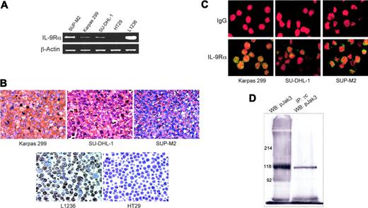Figure 1. ALK+ ALCL-cell lines express IL-9Rα. (A) RT-PCR studies show the presence of IL-9Rα mRNA in all ALK+ ALCL cells. The Hodgkin lymphoma-cell line L1236 was used as positive control and the colon carcinoma HT29-cell line as negative control. β-Actin shows equal loading. (B) Immunohistochemical staining of paraffin-embedded tissue sections from cell blocks confirmed the expression of IL-9Rα in all the ALK+ ALCL-cell lines. Similar to RT-PCR studies, L1236 and HT29 cells were used as positive and negative controls, respectively (original magnification × 200). (C) Confocal microscopy after immunofluorescence staining of cytospin slides with antibodies directed against IL-9Rα (bottom panel) or control IgG (top panel) demonstrates the expression of IL-9Rα in the ALK+ ALCL-cell lines, Karpas 299, SU-DHL-1, and SUP-M2 (original magnification × 600). (D) Immunoprecipitation and Western blotting show the physical association between γc and pJak3 in Karpas 299 cells. As shown in the right panel, immunoprecipitation was first performed on the cell lysate using anti-γc antibody followed by Western blotting using anti-pJak3 antibody. The left panel demonstrates a simultaneous control study where the lysate was analyzed only by Western blotting using an anti-pJak3 antibody. pJak3 bands are present at the expected molecular weight of 118 kDa in the 2 panels. Similar findings were noted when anti-Jak3 antibody was used instead of anti-pJak3 antibody (data not shown).