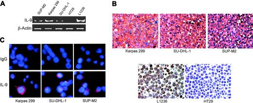 Figure 2. ALK+ ALCL-cell lines express IL-9. (A) RT-PCR studies demonstrate the presence of IL-9 mRNA in ALK+ ALCL cells. L1236 and HT29 cells were used as positive and negative controls, respectively. β-Actin demonstrates equal loading. (B) Immunohistochemical staining of the ALK+ ALCL-cell lines confirmed the expression of IL-9. L1236 and HT29 were used as positive and negative controls, respectively (original magnification × 200). (C) Confocal microscopy and immunofluorescence staining using specific antibody (bottom panel) or IgG (top panel) show the expression of IL-9 in ALK+ ALCL-cell lines (original magnification × 600).
