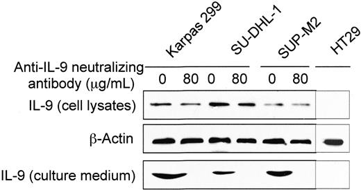 Figure 4. Autocrine release of IL-9 by ALK+ ALCL cells. Western blot studies show the presence of IL-9 protein in cell lysates from Karpas 299, SU-DHL-1, and SUP-M2 cells. Anti–IL-9–neutralizing antibody had no significant effect on IL-9 levels in the cell lysates. β-Actin shows equal loading of the proteins. Also, these studies show the presence of IL-9 in the culture medium from the same cells after being maintained in FBS-free medium for 12 hours. The anti–IL-9–neutralizing antibody (80 μg/mL) effectively bound to IL-9, as demonstrated by the lack of IL-9 in the culture medium after protein complexes were eluted. The negative control cells HT29 demonstrate lack of IL-9 in the cell lysate and the cell-culture medium. The experiment was repeated 2 times with consistent results.