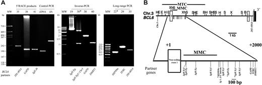 Figure 1. Detection of BCL6 translocations in gastric lymphoma. (A) Ethidium-bromide–stained gel showing BCL6 translocation products detected by various methods in all cases with non-Ig and examples of Ig as BCL6 fusion partner (5′-RACE on mRNA, inverse PCR on genomic DNA, and long-range PCR on genomic DNA). The case number is shown above each lane. cDNA indicates purified control cDNA amplified with control forward and reverse primers; dA, poly dA-tailed control cDNA amplified with oligo-dT anchor primer and the control reverse primer. (B) Top panel shows restriction map of the BCL6 gene, and distribution of the different breakpoints of BCL6 translocations identified in this study. Small vertical lines below the horizontal line indicate the positions of different translocation breakpoints. MTC indicates the major translocation breakpoints cluster; MMC, the major mutation cluster. Restriction sites: E, EcoRI; B, BamHI; H, HindIII; X, XbaI; S, SacI; Xh, Xhol. Lower panel shows the magnified description of top panel showing the region with different translocation breakpoints. The fusion partners of each BCL6 translocation are indicated. *DLCLML cases.