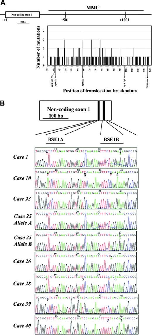 Figure 3. Mutational analysis of the BCL6 first intron and non-coding exon 1 in gastric lymphoma. (A) Distribution of somatic mutations in the BCL6 hypermutation region (nucleotides +358 to +1148 corresponding to the first transcription start site) covering MMC located at 5′ of the first intron detected in 24 cases of gastric lymphoma. The abscissa represents the position along the MMC region, starting from the first nucleotide of BCL6 non-coding exon 1. The ordinates correspond to the number of cases with somatic mutations at each position. Black bars indicate the number of cases with somatic mutations. Constitutional single-nucleotide polymorphisms (SNPs) were not counted. BCL6 translocation breakpoints within this region are indicated below the graph. • indicates the translocation breakpoints overlapping with somatic mutations detected; ○ indicates the translocation breakpoints not overlapping with somatic mutations detected. (B) BCL6-deregulating mutations in the two BCL6 binding motifs (BSE1A and BSE1B) located within the non-coding exon 1 of the gene detected in 8 cases of gastric lymphoma. The positions of the two BCL6 binding motifs are indicated above the case no. 1. The mutated nucleotides are underlined with the wild-type sequences shown below. *DLCLML cases.