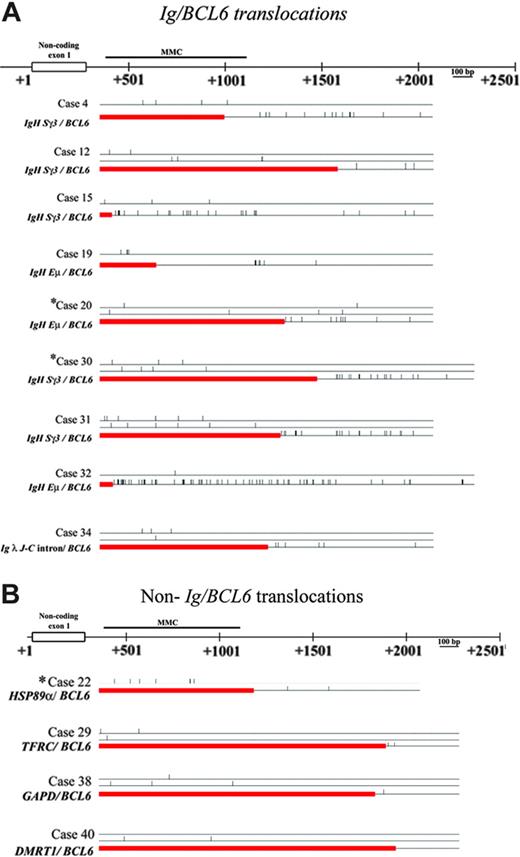 Figure 4. Frequency of somatic mutations in the BCL6 sequence in Ig/BCL6 and non-Ig/BCL6 rearranged alleles in gastric lymphoma. Diagrammatic illustration showing frequency of BCL6 somatic mutations detected in Ig/BCL6 (A) and non-Ig/BCL6 (B) rearranged alleles and their corresponding non-rearranged allele in each case. Straight horizontal lines represent non-rearranged alleles while rectangle boxes represent the fusion partner genes. Small vertical bars represent the mutations detected. *DLCLML cases.