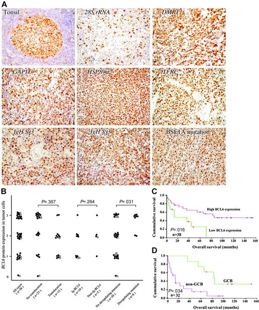Figure 5. BCL6 protein expression in gastric lymphoma. (A) The results of immunostaining for 5 gastric lymphoma cases with non-Ig/BCL6 translocations, 2 representative examples of cases with Ig/BCL6 translocations, and 1 example of cases with BSE1 mutation in the BCL6 binding motif are shown. Normal lymphoid tissue (tonsil) was used as a control for BCL6 immunostaining. *DLCLML case. (B) The distribution of BCL6 protein expression in tumor cells of the 38 cases of gastric lymphoma. 2-tailed χ2 test was used for statistical comparison. • indicates DLBCL cases; ○, DLCLML cases. (C) Kaplan-Meier curve showing BCL6 protein expression versus OS of gastric DLBCL and DLCLML patients. (D) In gastric DLBCL, the Kaplan-Meier curve showing the OS of the GCB subtype versus the non-GCB subtype.