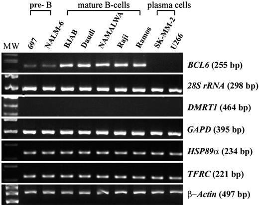Figure 6. Expression of BCL6 and its non-Ig translocation partner genes in a series of B-cell lines at different stages of differentiation by semiquantitative RT-PCR. β-Actin mRNA levels were used as control for the normalization of the amount of cDNA used for each sample.