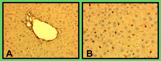 Immunohistologic staining of mouse liver for ADAMTS13. Liver was dissected from C57BL/6J mice, rinsed with PBS, fixed with 10% formalin, and sectioned at a thickness of 10 μm. The tissue section was stained with a goat anti–human ADAMTS13 (5 μg/mL; Bethyl Laboratory, Houston, TX) followed by an HRP-conjugated rabbit anti–goat IgG. The figure is a representation of immunohistologic staining of liver tissues from 5 mice. The lefthand panel depicts vascular staining, and the righthand panel, stellate cell staining.