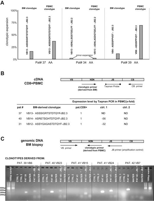 Figure 3. Molecular tracking of immunodominant clonotypes in BM biopsies and peripheral blood CD8+ cells from AA/MDS patients. (A) Independent sequencing of CDR3 regions derived from BM biopsy DNA and peripheral blood CD8+ RNA revealed identical or highly homologous clonotypes. Three examples are shown: in patients no. 37 and no. 39, identical expanded clonotypes were detected in both archived tissue and peripheral blood; patient no. 34 harbors 2 highly homologous minor clonotypes. PBMC indicates peripheral blood mononuclear cell. (B) The presence of clonotypes identified in archival BM tissue was tested on RNA from peripheral blood CD8+ cells using a quantitative Taqman assay. The presence and quantity of each shown clonotype was tested in the original patient and 2 healthy control samples obtained from our laboratory. Expression level in controls is shown as fold decrease in comparison to patient's values, which served as calibrator. ND indicates not detected. (C) Detection of blood-derived clonotypes in BM biopsies using nonquantitative clonotypic PCR. We were able to amplify peripheral blood-specific clonotypes in patient BM biopsies. Each clonotype was tested on genomic DNA from patient BM and genomic DNA from healthy controls. The primer set VB forward - JB reverse was used as an endogenous amplification control. The clonotypic primer derived from patient no. 40 also amplifies a nonspecific product of unexpected length in Ctrl1, possibly suggesting a partially rearranged TCR with high homology to patient's TCR sequence.