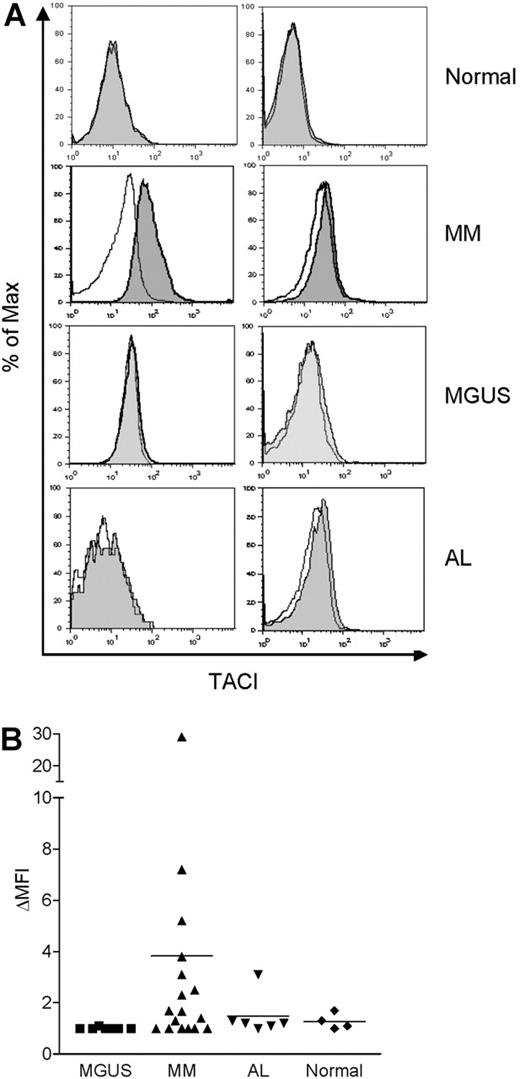 Figure 7. TACI is expressed in monocytes from MM patients. Bone marrow MNCs from 4 healthy controls, 17 MM patients, 7 MGUS patients, and 6 AL patients were costained with anti-TACI and anti-CD14 antibodies, and analyzed by flow cytometry. Representative histograms are shown in panel A. TACI is indicated by the gray shaded curves, and isotype control staining is indicated by the open curves in CD14+ gated cells. (B) Surface TACI levels are indicated by ΔMFI in CD14+ gated cells. The solid line represents the mean value for each group.