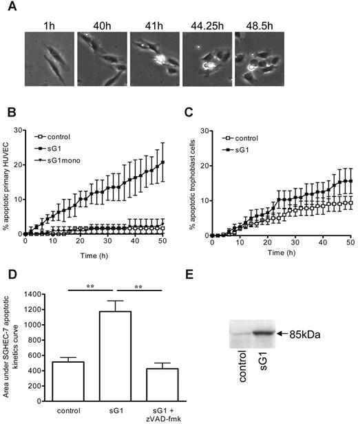 Figure 2. sHLA-G1 induces apoptosis of endothelial cells. (A) Time-lapse digital image microscopy of HUVECs after treatment with sHLA-G1. Apoptotic morphology could be detected over time, as evidenced by cytoplasmic retraction and a phase-bright appearance and membrane blebbing and blistering. These apoptotic changes are also illustrated in Videos S1 (sHLA-G1) and S2 (control). Images were visualized using an Olympus 1X70 microscope equipped with a UPlanF1 4×/0.13 NA objective. Images were captured using a Hamamatsu C4742-95-12NR camera and Image Pro Plus software version 4.5.1.29 (Media Cybernetics). (B) Kinetics curve of apoptosis induction. HUVECs were un-treated (control) or were incubated with sHLA-G1 (sG1; 1 μg/mL) or sHLA-G1mono (sG1mono; 1 μg/mL). Time-lapse microscopy was carried out to assess the appearance of apoptotic morphology. Although data were obtained every 15 minutes, data points are shown at 2-hour intervals for clarity. Mean ± SEM of pooled data from 4 experiments are shown. P < .001 between sHLA-G1 and sHLA-G1mono or control at the 50-hour time point, as determined by repeated-measures ANOVA with Tukey posttest. (C) Kinetics curve of apoptosis induction of trophoblast cells after incubation with sHLA-G1 compared with untreated (control) cells. Mean ± SEM of pooled data from 4 experiments is shown. Nonsignificance between sHLA-G1 and control at the 50-hour time point, as determined by the Mann-Whitney U test (P = .114) or paired t test (P = .127). (D) SGHEC-7 endothelial-cell apoptosis induction by sG1 (0.1 μg/mL), compared with untreated (control) cells, in the presence or absence of the caspase inhibitor zVAD-fmk assessed by time-lapse microscopy. Mean ± SEM of pooled data from 4 experiments is shown. Area under the curve was calculated from the kinetics curves. **P < .001, ANOVA. (E) Western blot analysis of p85 cleaved PARP expression. SGHEC-7 endothelial cells were incubated in the absence (control) or presence of sG1 (0.1 μg/mL) for 60 hours (confluent monolayer).
