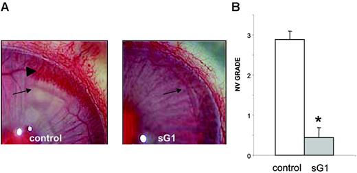 Figure 3. sHLA-G1 inhibits FGF2-induced corneal angiogenesis in vivo. Neovascularization was assessed 8 days after the insertion of implants containing FGF2 in rabbit corneal pockets, in the presence or absence of sHLA-G1 (5 μg/injection). (A) Representative image of each group (control, PBS subconjunctival injections; sG1, sHLA-G1 subconjunctival injections) at day 8 after FGF2 pellet implantation. (Arrows) Pellet implants. (Arrowhead) Newly formed vessels. The rabbit's eyes were examined under a OPMI-1 FC slit lamp biomicroscope (Carl Zeiss, Berlin, Germany) using a 2.4×/1.6 NA objective. (B) Neovascularization (NV) scores (mean ± SEM) for 8 implant groups. *P < .001, Student t test.