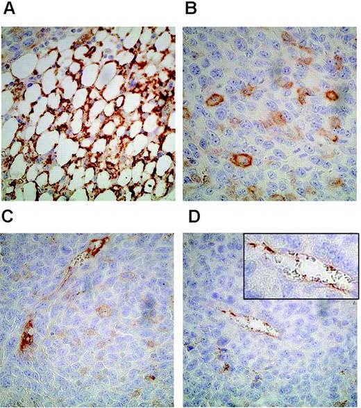 Figure 6. Immunohistochemical staining of Lewis lung carcinoma tumor sections with anti-CD160 mAb demonstrating CD160+ vessels. (A) Vessel network staining in brown was localized at the periphery of the tumor. Blood vessels in the periphery (B) and the center of the tumor (C-D) were also stained with CD160 mAb, whereas tumor cells remained unstained. Original magnification, × 400. (Inset magnification, × 4000)