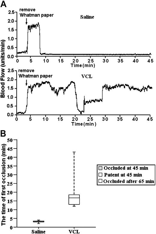 Figure 5. VCL treatment delayed the onset of unstable thrombus formation and prevented the stable thrombus formation. (A) The tracings are representative of blood flow in FeCl3-treated exposed carotid arteries of wild-type mice. The tail veins of these mice were injected with either saline (10 μL/g of body weight) or a saline solution of VCL (4.8 μg/g of body weight). Their blood flow was monitored for 45 minutes, including a 3-minute treatment starting at zero time with a strip of filter paper soaked in 10% FeCl3. The arrow indicates the time of removal of the FeCl3-containing strip of filter paper. (B) Box-plot graphs represent time of first occlusion of carotid arteries (blood flow less than 0.2 mL/min) from 6 WT mice given injections of saline and 6 WT mice given injections of VCL. The results show that the median time required for the first thrombotic occlusion in 6 WT mice treated with saline was 3 minutes, with a range of 2 to 4 minutes; the median time required for the first thrombotic occlusion in the WT mice treated with VCL was 17 minutes, with a range of 12 to 45 minutes. Arterial blood flow was occluded in all the WT mice treated with saline at the end of the monitoring period. Blood flow in all of WT mice treated with VCL was patent at the end of 45 minutes, but the stable thrombus formation occurred after 65 minutes. These results demonstrate VCL treatment delayed the onset of thrombus formation and prevented the stable thrombus formation during the 45-minute observation period. Therefore, it is clear that stable thrombus formation in the FeCl3-treated carotid arteries is GPIbα dependent. Bars represent extreme values for times of first occlusion.