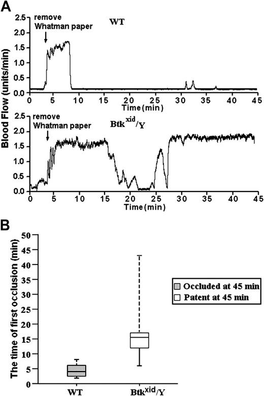 Figure 6. GPIb-dependent FeCl3-induced stable occlusion of the carotid artery requires Btk. (A) The tracings are representative of blood flow in FeCl3-treated exposed carotid arteries of wild-type and Btkxid/Y mice. Blood flow was monitored for 45 minutes, including a 3-minute treatment starting at zero time with a strip of filter paper soaked in 10% FeCl3. The arrow indicates the time of removal of the FeCl3-containing strip of filter paper. (B) Box-plot graphs represent time of first occlusion of carotid arteries (blood flow less than 0.2 mL/min) from 10 WT mice and 6 Btkxid/Y mice. The results show that the median time required for the first thrombotic occlusion in 10 Btk+/Y mice was 4.5 minutes, with a range of 2 to 8 minutes; the median time required for the first thrombotic occlusion in the Btkxid/Y arteries was 16 minutes, with a range of 6 to 45 minutes. Arterial blood flow was occluded in all the wild-type arteries at the end of the monitoring period. On the contrary, all of the treated Btkxid/Y arteries were patent at the end of the monitoring period. No occlusion occurred in the treated carotid artery of one Btkxid/Y mouse. These results demonstrate that Btk is required for GPIb-dependent stable thrombus formation in vivo. Bars represent extreme values for times of first occlusion.