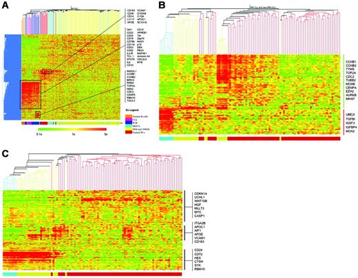 Figure 1. The GEP of WM is closer to CLL than MM. (A) Using 2162 gene probes that are variably expressed across the WM, CLL, and MM samples, unsupervised clustering of these samples together with normal B cells, PCs, MGUS, and SMM was performed. Selected genes that clustered together and were overexpressed in different sample clusters are highlighted. Restricting our analysis to only WM, CLL, and MM samples, unsupervised clustering was performed using published (B) CLL and (C) MM signatures. WM samples clustered predominantly with CLL samples and also exhibited closer approximation of the GEP using both signatures to CLL. Some genes of interests are highlighted. In both heatmaps, the colored bar at the bottom indicates the tumor type: blue, CLL; yellow, WM; and red, MM. The scale of the gene-expression data are similar to that in panel A.