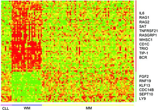 Figure 3. Gene-expression signature unique to WM. Seventy-three genes, 48 up-regulated and 25 down-regulated, constitute a gene-expression signature unique to WM. Here the samples are ordered according to diagnosis and genes according to fold difference in expression between WM and CLL and MM. Some interesting genes are highlighted. For a more complete list, see Table S1. The scale of the gene-expression data is similar to that in Figure 1A.