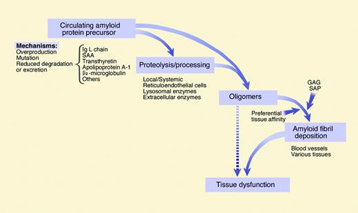 Figure 2. The general mechanisms involved in amyloid formation. The amyloidogenic protein can be synthesized in excess and persist in serum at high concentrations, as for monoclonal light chains or the acute-phase protein serum amyloid A (SAA), or can reach high serum concentrations because of reduced clearance, such as β2-microglobulin in chronic hemodialysis, or can be mutated as in hereditary amyloidosis. Certain proteins with intrinsic amyloidogenic properties, such as transthyretin, can cause amyloidosis late in life, as in senile systemic amyloidosis. Some of these proteins undergo a proteolytic remodeling that facilitates polymerization. The early protein aggregates can exert a direct cytotoxic effect. However, the role of early aggregates/oligomers has not yet been defined in all types of amyloidosis. The concurrence of tissue components and common constituents, such as glycosaminoglycans (GAGs) and serum amyloid P (SAP) component favors formation and persistence of tissue deposits of amyloid fibrils which contribute to causing the dysfunction of the target organ. Illustration by Marie Dauenheimer, adapted from Stone.5