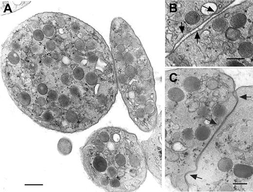 Figure 1. Ultrastructure of platelets in PRP from patient 1 as shown by standard transmission electron microscopy. Note the presence of platelet agglutinates and platelets of different size and shape that include round forms. Granules are randomly distributed and the platelets show no signs of activation (A). Platelets are often attached through discrete areas of surface contact; arrows highlight how protein bridges can be seen clearly at some interfaces (B), while at other interfaces the membrane surfaces appear to be in direct contact (C). Scale bar in panel A equals 0.5 μm; scale bars in panels B and C equal 200 nm.