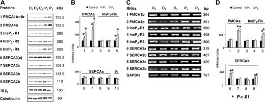 Figure 5. Abnormal expression of proteins involved in Ca2+ signaling in the patients. Platelets isolated from 3 healthy donors (C1-C3) and the 2 patients P1 and P2 were treated for simultaneous isolation of total lysate proteins and RNA. (A) Proteins were subjected to SDS-PAGE and WB using the isoform-specific antibodies indicated to detect PMCA, InsP3-R, and SERCA-type proteins as well as β3 and calreticulin (internal controls). In this figure and Figures 6, 7, the size of proteins is given in kilodaltons. (B) The intensity of the bands was quantified by densitometry and the mean values obtained for the 3 healthy donors were arbitrarily taken as 100%. The mean ± SD values (n = 8) of relative intensity (normalized to calreticulin) are shown in arbitrary units. *P < .01 compared with values from healthy donors. (C) Total RNA was subjected to specific RT-PCR to detect PMCA-, InsP3-R- and SERCA-RNA species, as well as GAPDH (internal control). Numbers indicate the sizes of PCR products in base pairs (bp). (D) The intensity of the bands was quantified as in panel B, except that the mean values (n = 6-10) of relative intensity were normalized to GAPDH. *P < .01 compared with values from healthy donors.