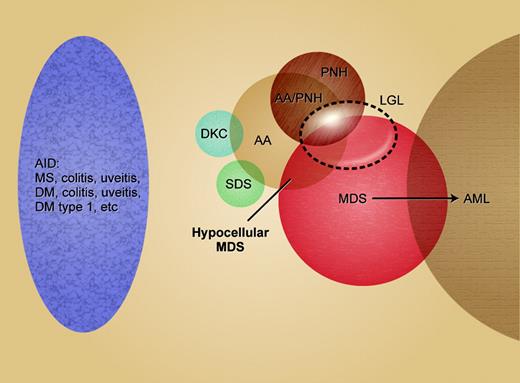 Figure 2. Venn diagram of the clinical and pathophysiologic relationships among the bone marrow failure syndromes, leukemia, and autoimmune diseases. Overlapping circles indicate difficulties in diagnostic discrimination and shared underlying mechanisms.