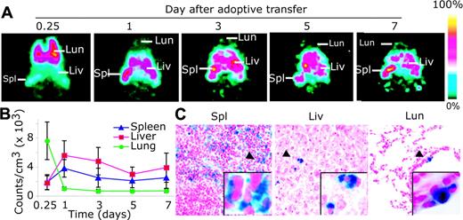 Figure 2. BMM tissue distribution assessed by SPECT and histologic tests. (A) BMM migration and tissue distribution of 111In-labeled BMMs are illustrated by SPECT analysis. Planar presentations of the tomographic images from a representative mouse show that radiolabeled BMMs initially accumulate in the lung (Lun), liver (Liv), and spleen (Spl). (B) To quantify BMM migration, ROIs were circumscribed and radioactive counts determined as a function of time (in days) after adoptive transfer. Data represent mean ± SEM for 4 mice. (C) Histologic analysis of Feridex-labeled BMMs, as determined by Prussian blue staining (blue cells), was consistent with SPECT data. BMMs in liver and lung were less than observed in spleen after day 7. Magnifications are (originals) × 100 and (insets) × 400.