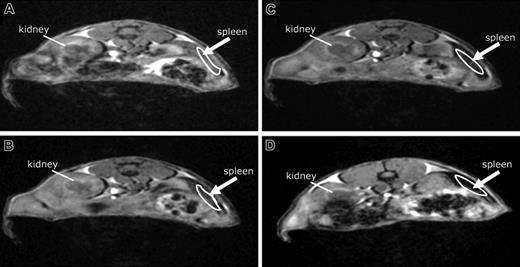Figure 3. BMM tissue distribution assessed by MRI tests. MRI tests were used to track BMM migration. Feridex was administered to BMMs in vitro. After Feridex labeling, the BMMs were administered intravenously to immune-competent mice. Signal loss (darkened areas) is shown in the spleen (arrow) over time from 0, 3, 6, and 24 hours (A, B, C, and D, respectively) after adoptive transfer, demonstrating cell migration.