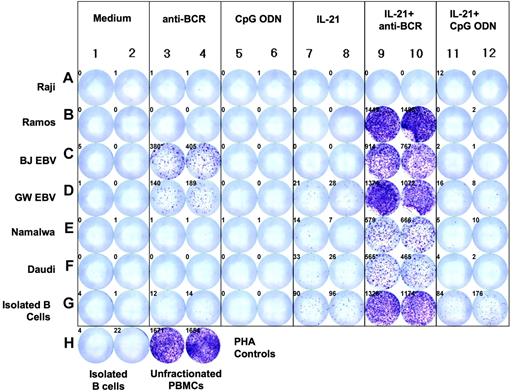 Figure 7. IL-21 induces de novo granzyme B synthesis and secretion by benign peripheral B cells and different B-cell lines. Standard cell lines, EBV transformed lymphoblasts, and B cells from healthy subjects (> 99.5% CD19+) were cultured in medium alone, anti-BCR, CpG ODN, IL-21, or combinations of these agents for 16 hours at a concentration of 100 000 cells/well. ELISPOT analysis for granzyme B was then performed. Controls included isolated B cells and unfractionated PBMCs treated with PHA.
