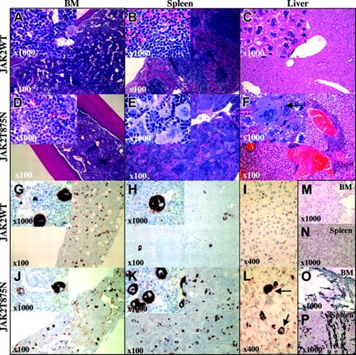 Figure 4. Histopathology of representative Balb/C animals that underwent transplantation with JAK2WT and JAK2T875N. Panels display hematoxylin and eosin (H&E)-stained sections from bone marrow (BM: A,D), spleen (B,E), and liver (C,F) from Balb/C mice that underwent transplantation with bone marrow cells transduced with either JAK2WT or JAK2T875N. Immunohistochemical staining for von Willebrand factor is shown (G-L) as well as reticulin staining of BM (M,O) and spleen (N,P). Similar features were observed in C57Bl/6 animals, showing high hematocrit levels that underwent transplantation with JAK2T875N. Arrows indicate infiltrated megakaryocytes. Original magnifications are indicated in each panel and inset.