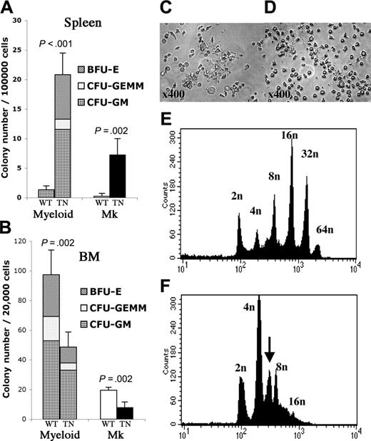 Figure 7. Animals that underwent transplantation with JAK2T875N show increased spleen myeloid colony-forming progenitors and abnormal megakaryocyte ploidy content. Myeloid (CFU-GM, CFU-GEMM, BFU-E) and megakaryocyte colony-forming assays were performed, respectively, in methylcellulose supplemented with IL-3, IL-6, SCF, and EPO and collagen-based media supplemented with TPO, IL-11, IL-3, and IL-6. The experiment was performed in triplicate and the mean plus or minus SD colony number obtained from spleen cells (A) or bone marrow cells (B) is shown. For myeloid colonies, average ratio of BFU-Es, CFU-GEMMs, and CFU-GMs is represented. Of note, BFU-Es were identified in JAK2T875N-derived colonies but not in JAK2WT-derived colonies. WT: JAK2WT; TN: JAK2T875N; Mk: megakaryocyte colonies; BM: bone marrow. Student t test was performed and P value is indicated. For ploidy analysis, bone marrow cells from animals that underwent transplantation were cultured for 4 days in liquid media containing TPO and SCF. Terminal differentiation with proplatelet formation was achieved with both JAK2WT- and JAK2T875N-expressing megakaryocytes (C,D). Cells were stained with propidium iodide (PI) and CD41+ cells were analyzed for ploidy content. Analyses were performed in duplicate and representative PI histograms are shown. Compared with JAK2WT (E), ploidy content in JAK2T875N megakaryocytes (F) was markedly reduced and an abnormal 6 n peak (arrow) was observed, consistent with a partial block at the initiation of the polyploidization process.