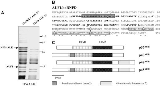 Figure 1. AUF1/hnRNPD is an ALK partner. (A) ALK-associated proteins were immunoprecipitated from ALK-positive SU-DHL1 and control FEPD cell lines using anti-ALK (ALK1) antibody. The band labeled AUF1, whose intensity was clearly different in NPM-ALK-positive and -negative protein extracts, was identified by proteomic and mass spectrometry analyses as p45AUF1. (B) Peptide sequence of AUF1. Bold type indicates the peptides used to identify AUF1 (31% recovery). The 2 alternative exons (2 and 7) are boxed. Seven tyrosine residues, common to all 4 isoforms, are found in the core of AUF1, and 14 are located in the alternative carboxy-terminal sequence encoded by exon 7, found in p42AUF1 and p45AUF1 isoforms. Except for tyrosine 244 (numbered according to the human sequence), found only in rat, mouse, and human AUF1 proteins, all these tyrosine residues are present in chicken and Xenopus AUF1 proteins. The conserved tyrosine residues are underlined and those predicted to be efficiently phosphorylated31 (score > 0.6) are encircled. (C) AUF1 protein contains 2 RNA recognition motifs (RRM1, RRM2) and comprises 4 isoforms, p37AUF1, p40AUF1, p42AUF1, and p45AUF1, depending on the presence or absence of the 19-amino acid N-terminal and/or 49-amino acid C-terminal inserts.