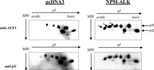 Figure 3. Hyperphosphorylation of AUF1 in NPM-ALK-expressing cells. Proteins were extracted from pcDNA3 and NPM-ALK-transfected NIH3T3 cells, and 700 μg were immunoprecipitated with the monoclonal anti-AUF1 antibody. The IPs were subjected to 2D gel analysis; after transfer, the nitrocellulose membrane was incubated with anti-AUF1 antibody (time of exposure, 1 minute), carefully stripped, and hybridized with secondary peroxidase-conjugated goat antimouse antibody (GAM PO); no signal was observed after 15 minutes of exposure, indicating that no more antibodies were bound to the membrane (data not shown). The membrane was then stripped again and probed with antiphosphotyrosine (anti-pY) antibody (time of exposure, 2 minutes). The hyperphosphorylated AUF1 variants differentially expressed between control and NPM-ALK-expressing NIH3T3 cells are shown by arrows.