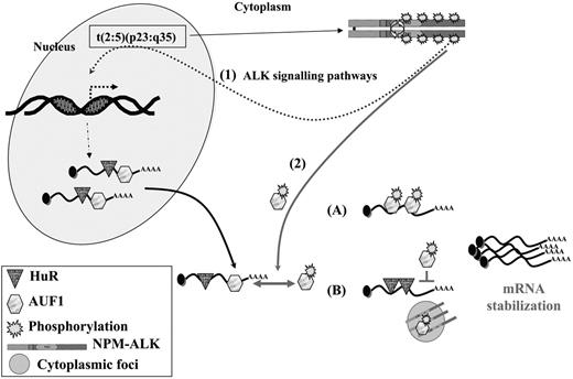 Figure 7. A model for NPM-ALK oncogenicity. In t(2:5)(p23:q35) cells, NPM-ALK enhances transcription of target genes (1) through known signaling pathways, including PLCγ, PI3K, and STAT3/5 activation. Some of these up-regulated genes encode ARE-containing mRNAs whose stability involves AU-BPs. In addition, NPM-ALK enhances mRNA stability (2) by inducing hyperphosphorylation of AUF1. Depending on whether AUF1 is a stabilizing or a destabilizing factor, its posttranslational modification respectively either increases (A) or decreases (B) its affinity/binding for its target mRNAs, in either case leading to their increased stability. Decreased affinity of a destabilizing protein might favor the binding of a stabilizing AU-BP, such as HuR, thus contributing to increased stability of ARE-containing mRNAs. The phosphorylated AUF1 form might also be trapped together with NPM-ALK in cytoplasmic granules (B), allowing access of stabilizing HuR to ARE-mRNAs. In conclusion, enhancing transcription and increasing stability of mRNAs encoding for proteins which are key players of cell proliferation are 2 facets of NPM-ALK activity which both contribute to its oncogenicity.