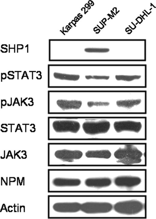 Figure 1. Expression of SHP1, NPM-ALK, JAK3, and STAT3 in 3 ALK+ALCL cell lines, Karpas 299, SUP-M2, and SU-DHL-1. Only SUP-M2 expressed SHP1, and this cell line also had relatively lower levels of pSTAT3, pJAK3, and JAK3 compared with the other 2 cell lines.