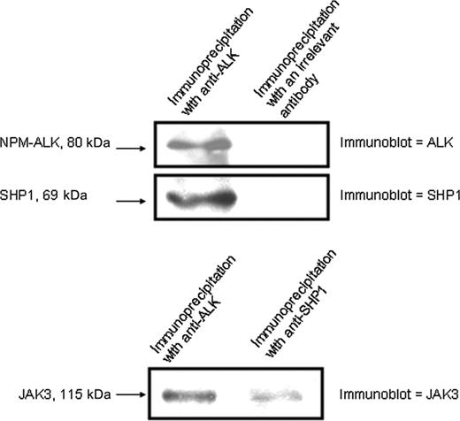 Figure 5. SHP1 coimmunoprecipitated with NPM-ALK and JAK3. Coimmunoprecipitation studies indicated that SHP1 physically interacts with NPM-ALK and JAK3.