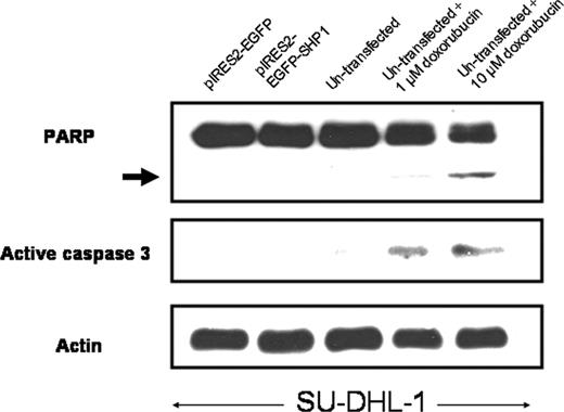 Figure 7. SHP1 induced no significant apoptosis. In addition to the lack of an increase in the sub-G0/1 cell population, SHP1 expression in SU-DHL-1 cells also did not lead to detectable cleaved PARP product (arrow) and active caspase-3. Nontransfected SU-DHL-1 cells treated with different doses of doxorubicin served as positive controls.