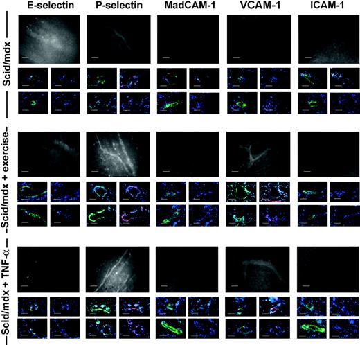 Figure 3. Characterization of endothelial adhesion molecules in scid/mdx mice. Adhesion molecule expression on the endothelium of dystrophic muscle was evaluated with the use of in vivo staining followed by observation with intravital microscopy and on cryosections before and after TNF-α stimulation or muscle exercise. Fluorescein-protein (F/P) ratios for mAbs were 3.0 for anti-E- and anti-P-selectin mAbs, 3.2 for anti-ICAM-1 mAb, 2.9 for anti-MAdCAM-1 mAb, and 3.4 for anti-VCAM-1 mAb. An anti-human Ras mAb was used as control and had an F/P ratio of 3.6 (data not shown). Murine vessels of scid/mdx mice expressed P-selectin in basal condition as shown by in vivo staining. Moreover, after muscle exercise and TNF-α stimulation, we registered significant improvement in the number of vessels expressing P-selectin and VCAM-1. In vivo staining data were confirmed by immunofluorescence staining showing the expression of P-selectin or VCAM-1 (in red) but not E-selectin, MadCAM-1, or ICAM-1 in CD31+ venules (shown in the middle line of each condition), αSMA-positive arterioles (shown in the lower line of each condition), or murine muscle vessels (both in green). DAPI-positive nuclei are shown in blue. Vessels were acquired at ×40 magnification. Scale bars represent 100 μm for intravital microscopy (black-and-white images) and 10 μm for immunostaining (color images).