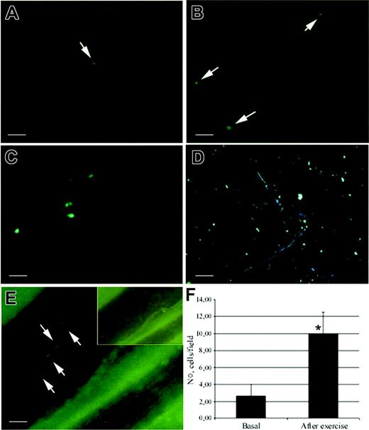 Figure 5. Evaluation of the effect of muscle exercise on the recruitment of human CD133+ cells. CD133+ stem cells were incubated with PkH2 green to allow detection by fluorescence microscopy with a perfusion technique that showed the vasculature in 3 dimensions. Intra-arterially injected CD133+ stem cells were rarely found in the vessels of dystrophic muscles before exercise (A, C). In contrast, after swimming exercise intra-arterially injected scid/mdx mice showed an increased number of adhered cells in the capillary network (B, D) and to large vessels (E). (E) Large vessels perfused with a rubber silicon fluid were detected in transillumination. (inset) Cells were not evident in other fluorescence acquisitions, confirming that positively registered cells in vessels were not artefacts. (F) Statistical evaluation by Student t test of the number of CD133+ cells adhered to the vessel and confirmed significant improvement in recruitment after exercise. *P < .05. Scale bars represent 100 μm (A-C), 200 μm (D), and 25 μm (E). In panels A-E, arrows indicate the labeled cells. Error bars in panel F indicate standard deviation.
