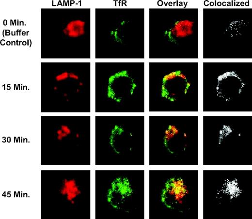 Figure 6. Anti-hTfR IgG3-Av directs the TfR to an intracellular compartment containing the lysosomal marker LAMP-1. ARH-77 cells treated with 11 nM anti-hTfR IgG3-Av for 0 (buffer control), 15, 30, or 45 minutes were fixed, permeabilized, and stained as described in “Materials and methods.” Cells were then analyzed by confocal microscopy. The image of a representative cell from each time point is shown immunostained for TfR (green) and LAMP-1 (red) with overlay. The area where colocalization occurs is shown in white. The percent colocalization was calculated as described in “Confocal microscopy” (Table 1).