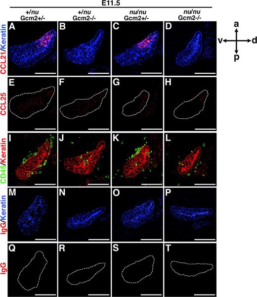 Figure 6. Chemokine expression and fetal thymus colonization in Foxn1/Gcm2-deficient mice. Sagittal sections of frozen embryos from indicated mice were analyzed as in Figure 4. Scale bars indicate 100 μm.