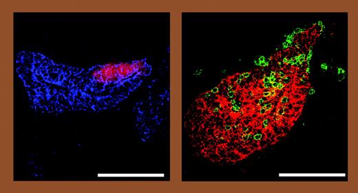 Chemokine expression and fetal thymus colonization: a role for the parathyroid. See the complete figure in the article beginning on page 2531.