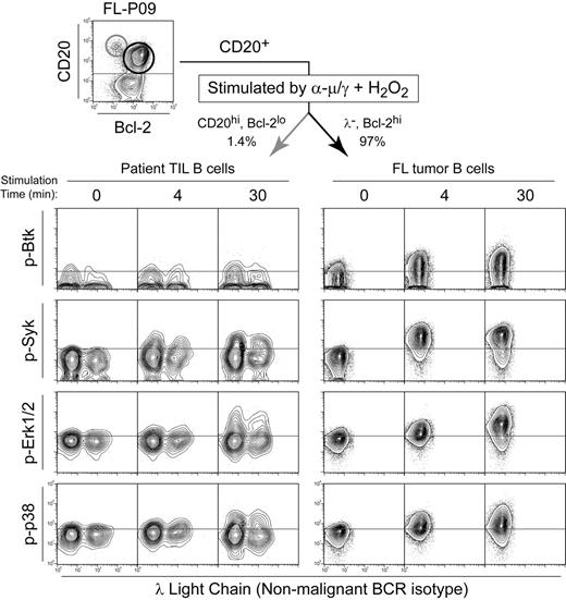 Figure 5. Tumor cell–specific BCR-mediated Btk, Syk, Erk1/2, and p38 signaling. Flow cytometry contour plots of FL patient biopsy cells (FL-P09) stimulated by BCR cross-linking plus H2O2 (α-μ/γ + H2O2) for 4 or 30 minutes or left unstimulated (0 minute). BCR-mediated phosphorylation of Btk, Syk, Erk1/2, and p38 was compared in FL B cells (CD20+ Bcl-2hi λ–, dark arrow) and nonmalignant B cells (CD20hi Bcl-2lo, light arrow).