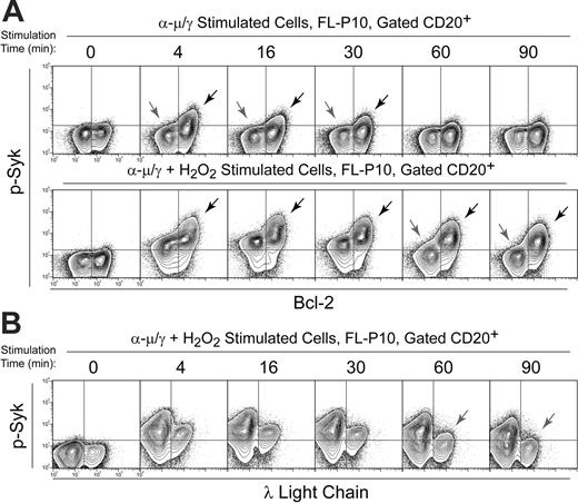 Figure 6. Tumor cell–specific BCR-mediated Syk signaling. (A) Flow cytometry contour plots of FL patient biopsy cells (FL-P10) stimulated by BCR cross-linking alone (α-μ/γ) or by a combination of BCR cross-linking and H2O2 (α-μ/γ+ H2O2) for various times (4, 16, 30, 60, 90 minutes) or left unstimulated (0 minute). BCR-mediated phosphorylation of Syk was compared in CD20+ Bcl-2+ FL B cells and CD20+ Bcl-2– nonmalignant B cells (refer to Figure 1). Dark arrows indicate greater Syk signaling in Bcl-2+ FL tumor B cells than in nonmalignant host B cells. Light arrows indicate λ isotype B cells that failed to activate Syk in response to BCR cross-linking. (B) Flow cytometry contour plots of FL patient biopsy cells (FL-P10) stimulated by a combination of BCR cross-linking and H2O2 (α-μ/γ + H2O2) for various times (4, 16, 30, 60, or 90 minutes) or left unstimulated (0 minute). BCR-mediated phosphorylation of Syk was measured in CD20+ κ isotype B cells and compared with that in λ isotype nonmalignant B cells (all λ– cells are κ+). Dark arrows indicate sustained Syk signaling in Bcl-2+ FL tumor B cells. Light arrows indicate where Syk signaling in λ isotype B cells differed from κ isotype B cells.