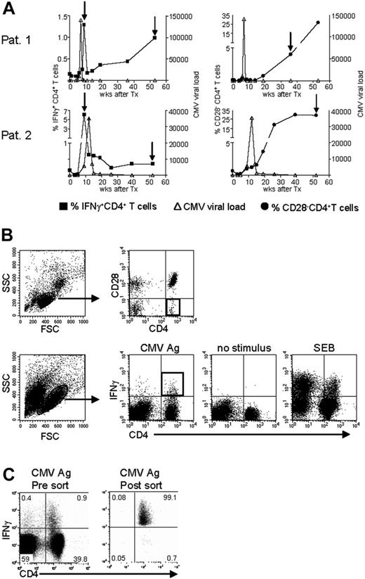 Figure 2. Isolation of CMV-specific CD4+ T cells found early and late during primary CMV infection. (A) Top panels show patient 1; bottom panels, patient 2. In the left-hand panels, kinetics of CMV viral load as measured by quantitative PCR (right y-axis) are plotted together with the percentage of CMV-specific IFNγ-producing CD4+ T cells (left y-axis). In the right-hand panels, the CMV viral load is plotted together with the percentage of CD4+CD28– T cells (left y-axis). On the x-axes, the time is indicated as weeks after transplantation, which coincides with the moment of infection. The arrows indicate the time points at which CMV-specific IFNγ-producing or CD28–CD4+ T cells were isolated. (B) Sorting gates of CMV-specific CD4+ T cells in samples at a late time point after infection. Top panels show gating on lymphocytes and subsequently on CD4+CD28– T cells. Bottom panels show gating on (activated) lymphocytes followed by gating IFNγ-producing CD4+ T cells upon stimulation with CMV Ag. Unstimulated cells and SEB-stimulated cells were used to set the gates. Black squares indicate the populations of CMV-specific cells that were isolated. (C) Example of purity of sorted IFNγ+ CD4+ T cells. Left panel shows sample before sort; right panel shows the result after sorting. Numbers indicate the percentages within the corresponding quadrants.