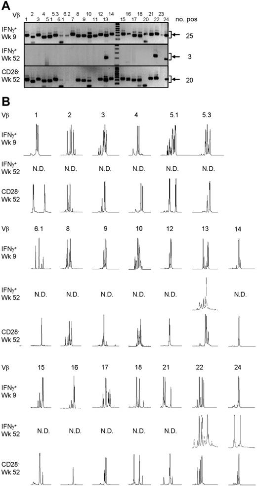 Figure 4. Late CMV-specific CD4+ T cells have a very restricted TCR Vβ usage. (A) Pictures show the bands on gel retrieved after PCRs for the different Vβ families of patient 2. Analysis was performed on cDNA obtained after amplification of total RNA isolated from the different sorted CMV-specific CD4+ T-cell populations. Arrows on the right side indicate the height at which the specific bands for the Vβ families can be found. Smaller bands at the bottom of the picture are primer dimers and should therefore not be considered specific. Numbers on the right indicate the number of Vβs present in that sample. (B) Results of the spectratype of Vβ families which were found in both early and late CMV-specific CD4+ T-cell populations of patient 2. Each peak represents a CDR3 region with a certain length spaced by 3 nucleotides. Numbers indicate the corresponding Vβ; on the left side, the different cell populations are mentioned. N.D. indicates not detectable in that cell population.